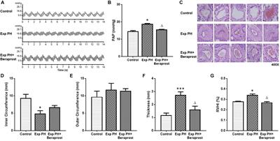 Mechanism of Beraprost Effects on Pulmonary Hypertension: Contribution of Cross-Binding to PGE2 Receptor 4 and Modulation of O2 Sensitive Voltage-Gated K+ Channels